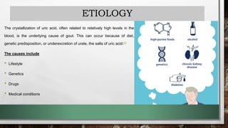 ETIOLOGY
The crystallization of uric acid, often related to relatively high levels in the
blood, is the underlying cause of gout. This can occur because of diet,
genetic predisposition, or underexcretion of urate, the salts of uric acid.[4]
The causes include
• Lifestyle
• Genetics
• Drugs
• Medical conditions
 