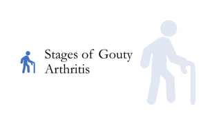 Stages of Gouty
Arthritis
 
