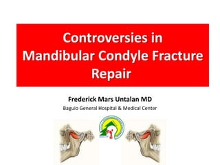 Controversies in MandibularCondyle Fracture Repair  Frederick Mars Untalan MD Baguio General Hospital & Medical Center 