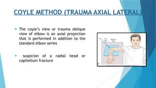 Lateral Coyle Method Routine GOWRI -elbow radiographic positioning.pptx