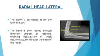 GOWRI -elbow radiographic positioning.pptx