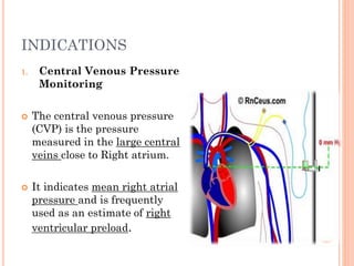 HAEMODYNAMIC MONITORING – CVP, PAC AND IBP | PPTX