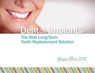 Dental Implants
The Best Long-Term
Tooth Replacement Solution
 