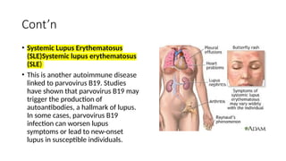 Cont’n
• Systemic Lupus Erythematosus
(SLE)Systemic lupus erythematosus
(SLE)
• This is another autoimmune disease
linked to parvovirus B19. Studies
have shown that parvovirus B19 may
trigger the production of
autoantibodies, a hallmark of lupus.
In some cases, parvovirus B19
infection can worsen lupus
symptoms or lead to new-onset
lupus in susceptible individuals.
 