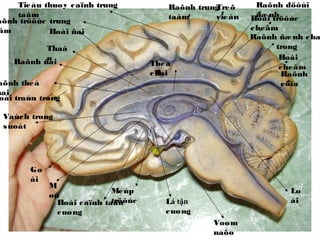 Sapiosexual  Khi ngoại hình nóng bỏng cũng không bằng một bộ não thông  minh hay chuyện yêu đương đến từ hai cái đầu đặc chữ
