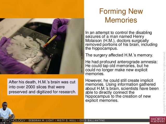 gp 6 the inability to remember past events is as the inability to form new memories is