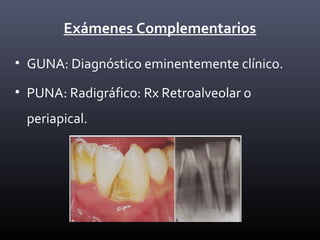 Exámenes Complementarios
• GUNA: Diagnóstico eminentemente clínico.
• PUNA: Radigráfico: Rx Retroalveolar o
periapical.
 