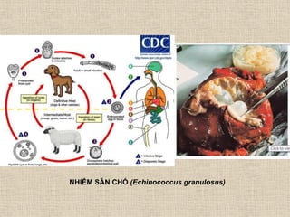 NHIỄM SÁN CHÓ (Echinococcus granulosus)
 
