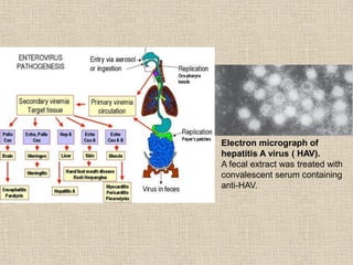 Electron micrograph of
hepatitis A virus ( HAV).
A fecal extract was treated with
convalescent serum containing
anti-HAV.
 