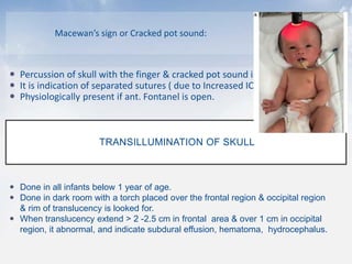 Macewan’s sign or Cracked pot sound:
 Percussion of skull with the finger & cracked pot sound is heard.
 It is indication of separated sutures ( due to Increased ICP)
 Physiologically present if ant. Fontanel is open.
TRANSILLUMINATION OF SKULL
 Done in all infants below 1 year of age.
 Done in dark room with a torch placed over the frontal region & occipital region
& rim of translucency is looked for.
 When translucency extend > 2 -2.5 cm in frontal area & over 1 cm in occipital
region, it abnormal, and indicate subdural effusion, hematoma, hydrocephalus.
 