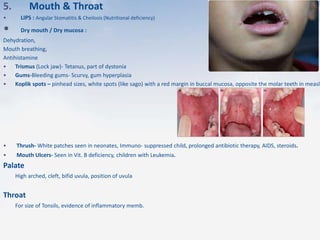 5. Mouth & Throat
• LIPS : Angular Stomatitis & Cheilosis (Nutritional deficiency)
• Dry mouth / Dry mucosa :
Dehydration,
Mouth breathing,
Antihistamine
• Trismus (Lock jaw)- Tetanus, part of dystonia
• Gums-Bleeding gums- Scurvy, gum hyperplasia
• Koplik spots – pinhead sizes, white spots (like sago) with a red margin in buccal mucosa, opposite the molar teeth in measle
• Thrush- White patches seen in neonates, Immuno- suppressed child, prolonged antibiotic therapy, AIDS, steroids.
• Mouth Ulcers- Seen in Vit. B deficiency, children with Leukemia.
Palate
High arched, cleft, bifid uvula, position of uvula
Throat
For size of Tonsils, evidence of inflammatory memb.
 