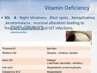 Vitamin Deficiency
• Vit. A : Night blindness , Bitot spots , Xeropthalmia
,keratomalacia , mucosal alteration leading to
frequent respiratory and GIT infections.
• Vit. B :
Bitot spots : Chalky grey spots
on the temporal side of corneo-
scleral junction.
Thiamine B1 Beri-Beri
Riboflavin B2 Glossitis , Cheilosis, keratitis
Niacin B3 Pellagra
( diarrhoea, dermatitis , demetia )
Folic acid Megaloblastic anaemia,glossitis
Cobalamine B12 Megaloblastic
 