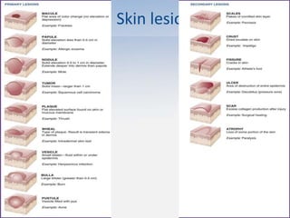 Skin lesions
 