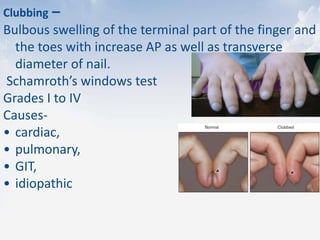 Clubbing –
Bulbous swelling of the terminal part of the finger and
the toes with increase AP as well as transverse
diameter of nail.
Schamroth’s windows test
Grades I to IV
Causes-
• cardiac,
• pulmonary,
• GIT,
• idiopathic
 
