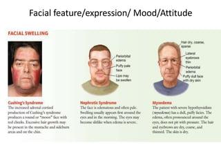 Facial feature/expression/ Mood/Attitude
 