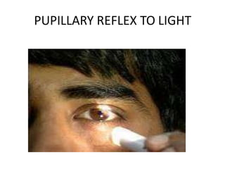 PUPILLARY REFLEX TO LIGHT
 