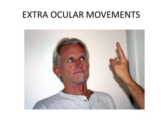 EXTRA OCULAR MOVEMENTS
 