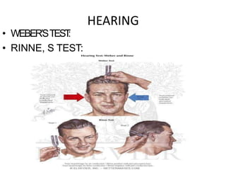 HEARING
• WEBER’STEST:
• RINNE, S TEST:
 