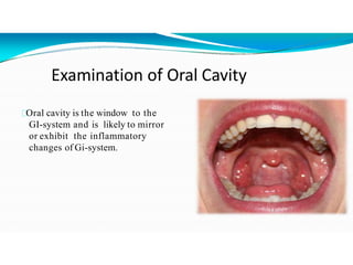 Examination of Oral Cavity
Oral cavity is the window to the
GI-system and is likely to mirror
or exhibit the inflammatory
changes of Gi-system.
 