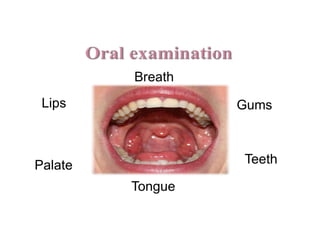 Lips Gums
Teeth
Tongue
Palate
Breath
 