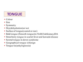 TONGUE
 Colour
 Size
 Symmetry
 Dry(dehydration)or wet
 Surface of tongue(coated or raw)
 Bald tongue (Smooth tongue)in Vit-B12 deficiency,IDA
 Strawberry tongue in scarlet fever and kawaski disease
 Scrotal tongue in down syndrome
 Geographical tongue isbenign
 Tongue tie(ankyloglossia)
 