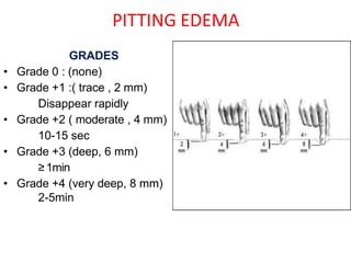 PITTING EDEMA
GRADES
• Grade 0 : (none)
• Grade +1 :( trace , 2 mm)
Disappear rapidly
• Grade +2 ( moderate , 4 mm)
10-15 sec
• Grade +3 (deep, 6 mm)
≥1min
• Grade +4 (very deep, 8 mm)
2-5min
 