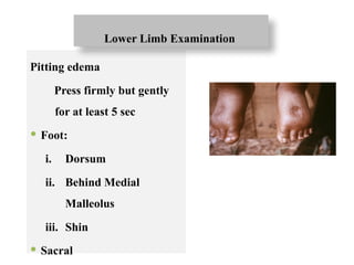 Pitting edema
Press firmly but gently
for at least 5 sec
 Foot:
i. Dorsum
ii. Behind Medial
Malleolus
iii. Shin
 Sacral
Lower Limb Examination
 