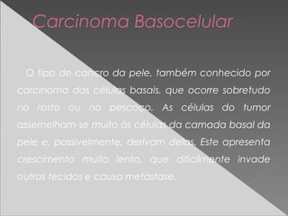 Carcinoma Basocelular
O tipo de cancro da pele, também conhecido por
carcinoma das células basais, que ocorre sobretudo
no rosto ou no pescoço. As células do tumor
assemelham-se muito às células da camada basal da
pele e, possivelmente, derivam delas. Este apresenta
crescimento muito lento, que dificilmente invade
outros tecidos e causa metástase.
 