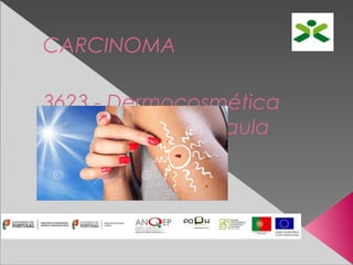 CARCINOMA
3623 - Dermocosmética
Formadora: Ana Paula
Ferreira
 
