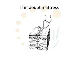 If in doubt mattress
 