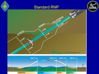Standard RNP

 