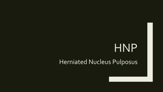 HNP
Herniated Nucleus Pulposus
 