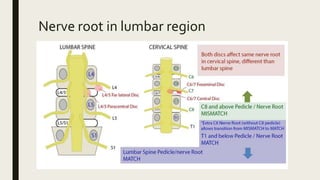 Nerve root in lumbar region
 