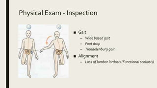 Physical Exam - Inspection
■ Gait
– Wide based gait
– Foot drop
– Trendelenburg gait
■ Alignment
– Loss of lumbar lordosis (Functional scoliosis)
 