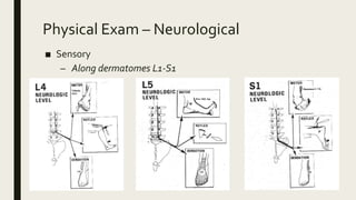 Physical Exam – Neurological
■ Sensory
– Along dermatomes L1-S1
 