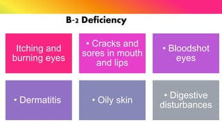 B‐2 Deficiency
Itching and
burning eyes
• Cracks and
sores in mouth
and lips
• Bloodshot
eyes
• Dermatitis • Oily skin
• Digestive
disturbances
 