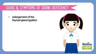 •  enlargementofthe
thyroidgland(goiter)
SIGNS & SYMPTOMS OF IODINE DEFICIENCY
 