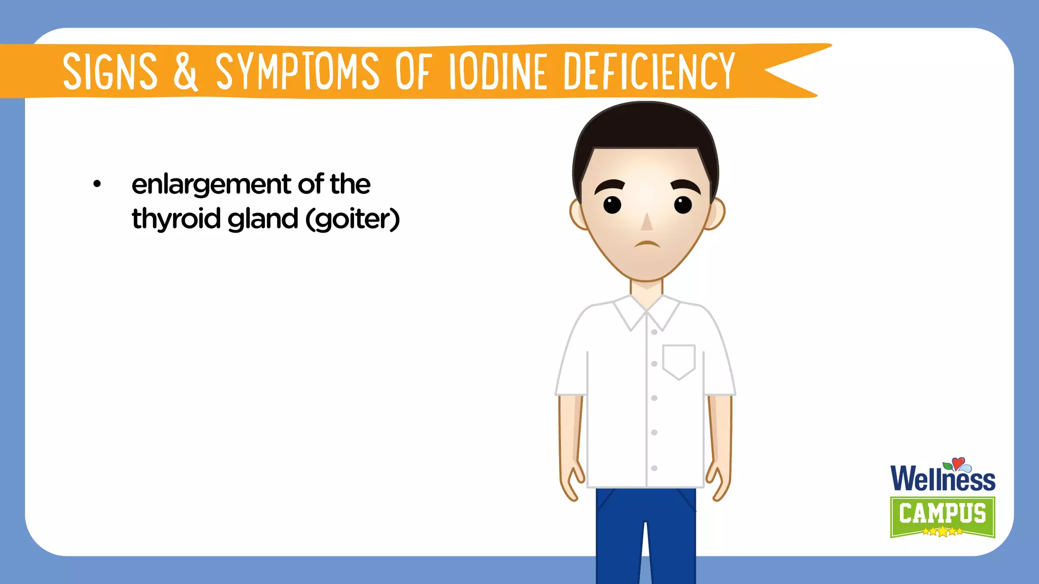 •  enlargementofthe
thyroidgland(goiter)
SIGNS & SYMPTOMS OF IODINE DEFICIENCY
 