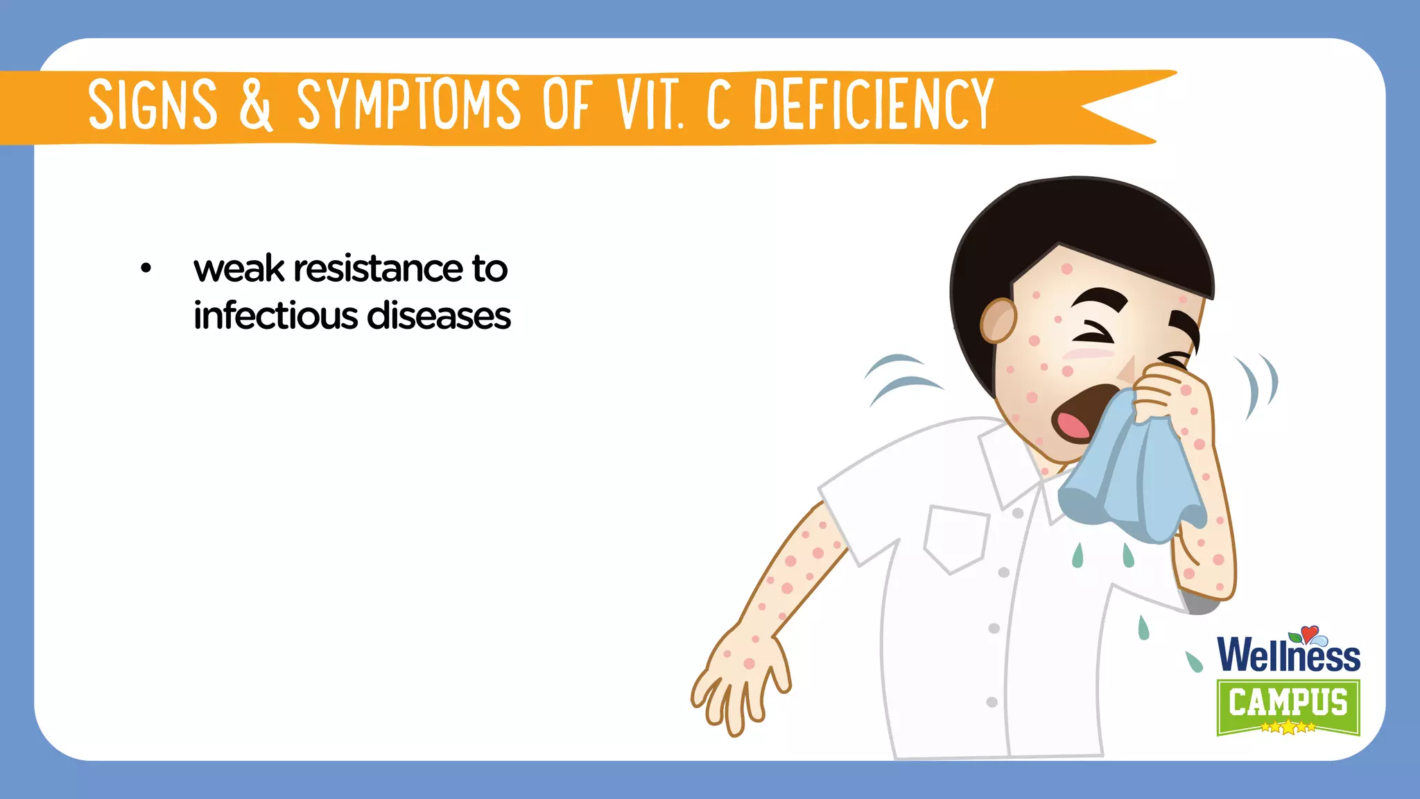 •  weakresistanceto
infectiousdiseases
SIGNS & SYMPTOMS OF VIT. C DEFICIENCY
 