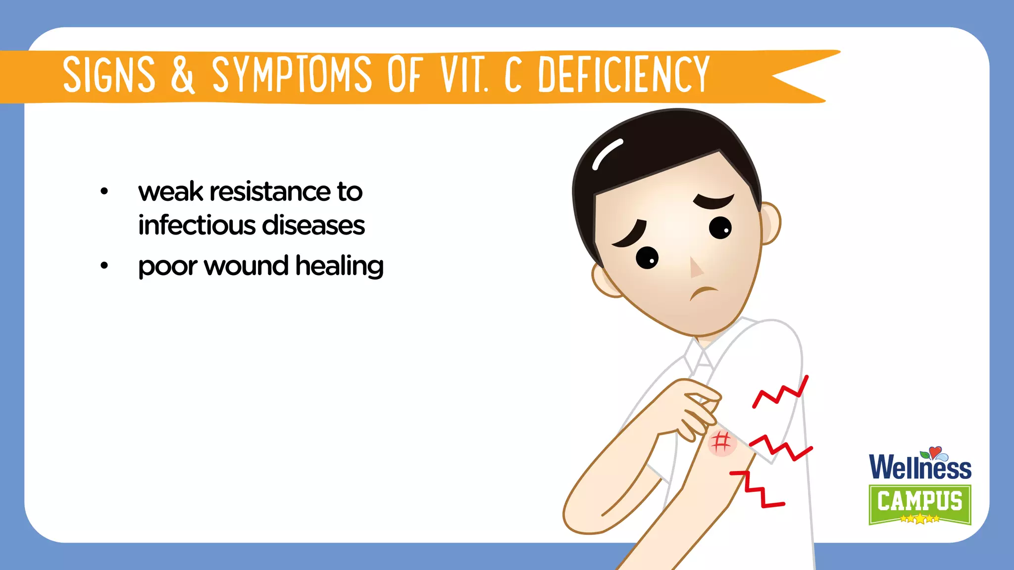 •  weakresistanceto
infectiousdiseases
•  poorwoundhealing
SIGNS & SYMPTOMS OF VIT. C DEFICIENCY
 