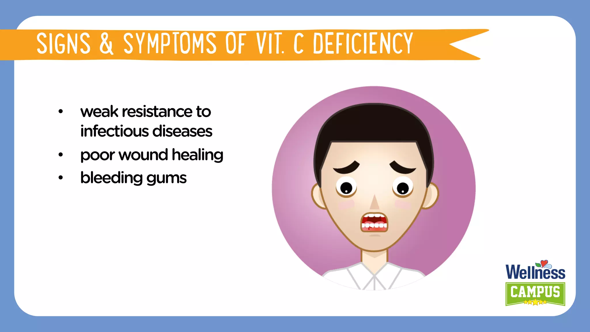 •  weakresistanceto
infectiousdiseases
•  poorwoundhealing
•  bleedinggums
SIGNS & SYMPTOMS OF VIT. C DEFICIENCY
 