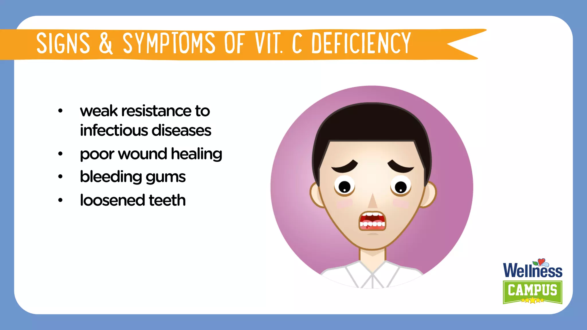 •  weakresistanceto
infectiousdiseases
•  poorwoundhealing
•  bleedinggums
•  loosenedteeth
SIGNS & SYMPTOMS OF VIT. C DEFICIENCY
 
