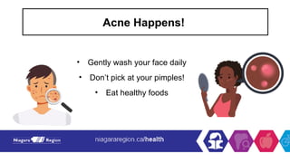 Acne Happens!
• Gently wash your face daily
• Don’t pick at your pimples!
• Eat healthy foods
 