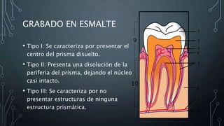 GRABADO EN ESMALTE
• Tipo I: Se caracteriza por presentar el
centro del prisma disuelto.
• Tipo II: Presenta una disolución de la
periferia del prisma, dejando el núcleo
casi intacto.
• Tipo III: Se caracteriza por no
presentar estructuras de ninguna
estructura prismática.
 