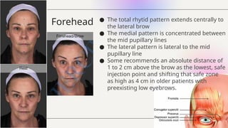 Grabb Botulinum Toxin the mechanism of action.pptx