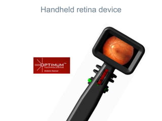 Handheld retina device
 