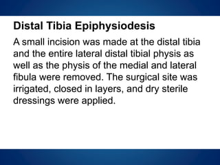 Distal Tibia Epiphysiodesis
A small incision was made at the distal tibia
and the entire lateral distal tibial physis as
well as the physis of the medial and lateral
fibula were removed. The surgical site was
irrigated, closed in layers, and dry sterile
dressings were applied.
 