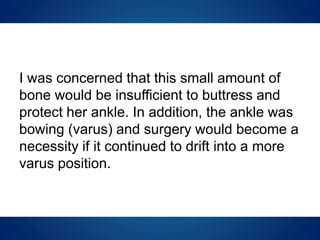An x-ray of Grace’s lower limbs. Note the right limb’s lack of space
around the physes and the disconnected parts of the fibula.
 