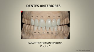 Prof. Sônia Popiolek Caetano
DENTES ANTERIORES
CARACTERÍSTICAS INDIVIDUAIS
IC – IL - C
43
23
22
21
13 12 11
42 33
32
31
41
 