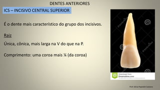 Prof. Sônia Popiolek Caetano
DENTES ANTERIORES
ICS – INCISIVO CENTRAL SUPERIOR
É o dente mais característico do grupo dos incisivos.
Única, cônica, mais larga na V do que na P.
Comprimento: uma coroa mais ¼ (da coroa)
Raiz
 